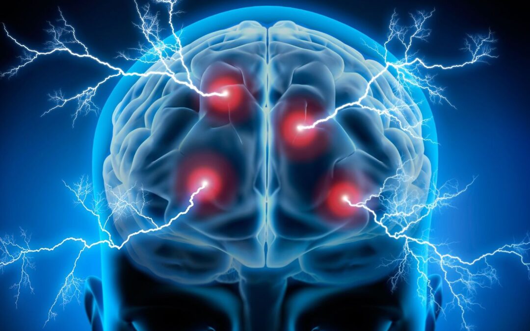 La SANTÉ EN ACTU : l&rsquo; ÉPILEPSIE EN QUESTION